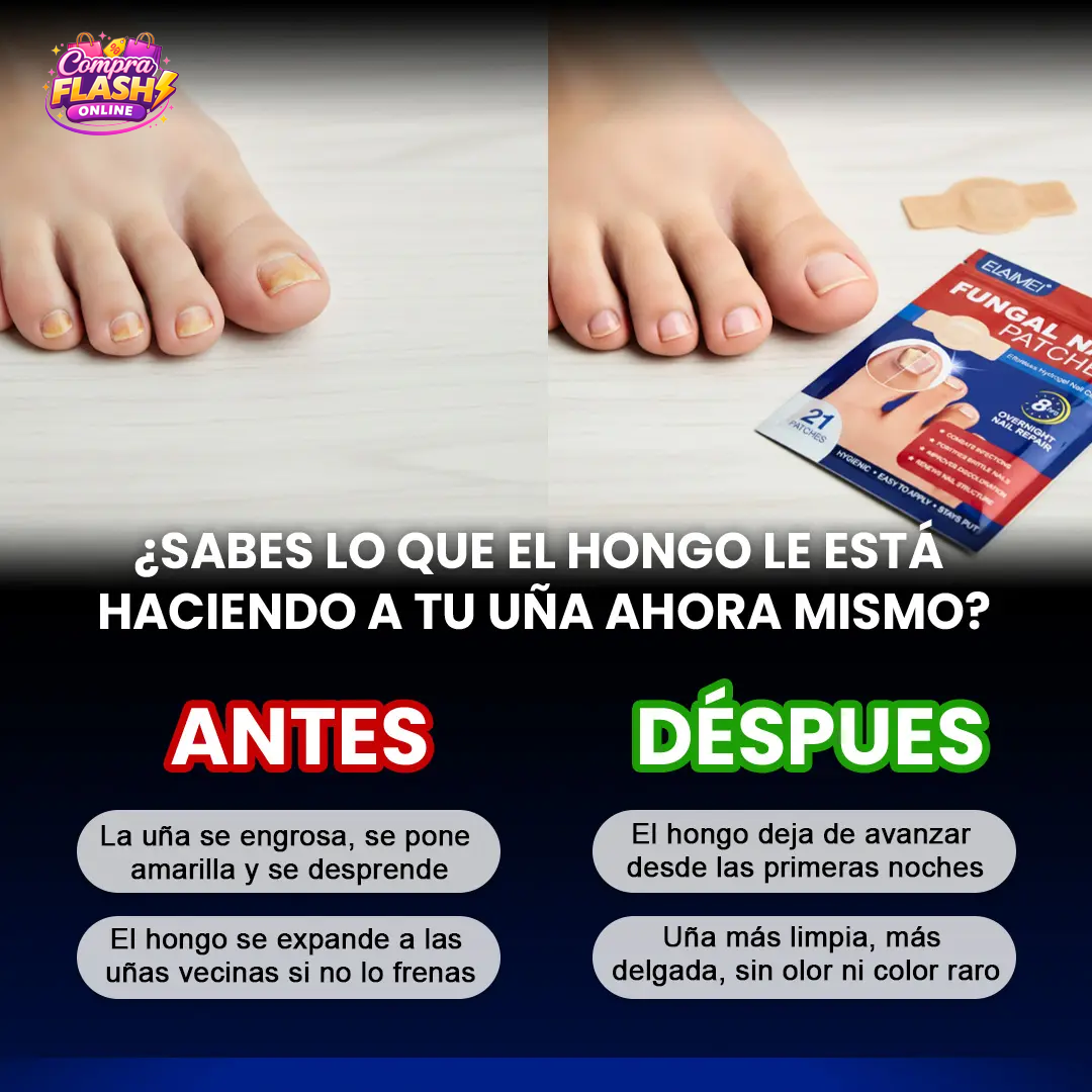 🔥 PACK 2x1 – SEGUNDA UNIDAD Y ENVÍO GRATIS 🦶PARCHES ANTIHONGOS PARA UÑAS DE PIES FUNGISTOP™ ⭐️⭐️⭐️⭐️⭐️