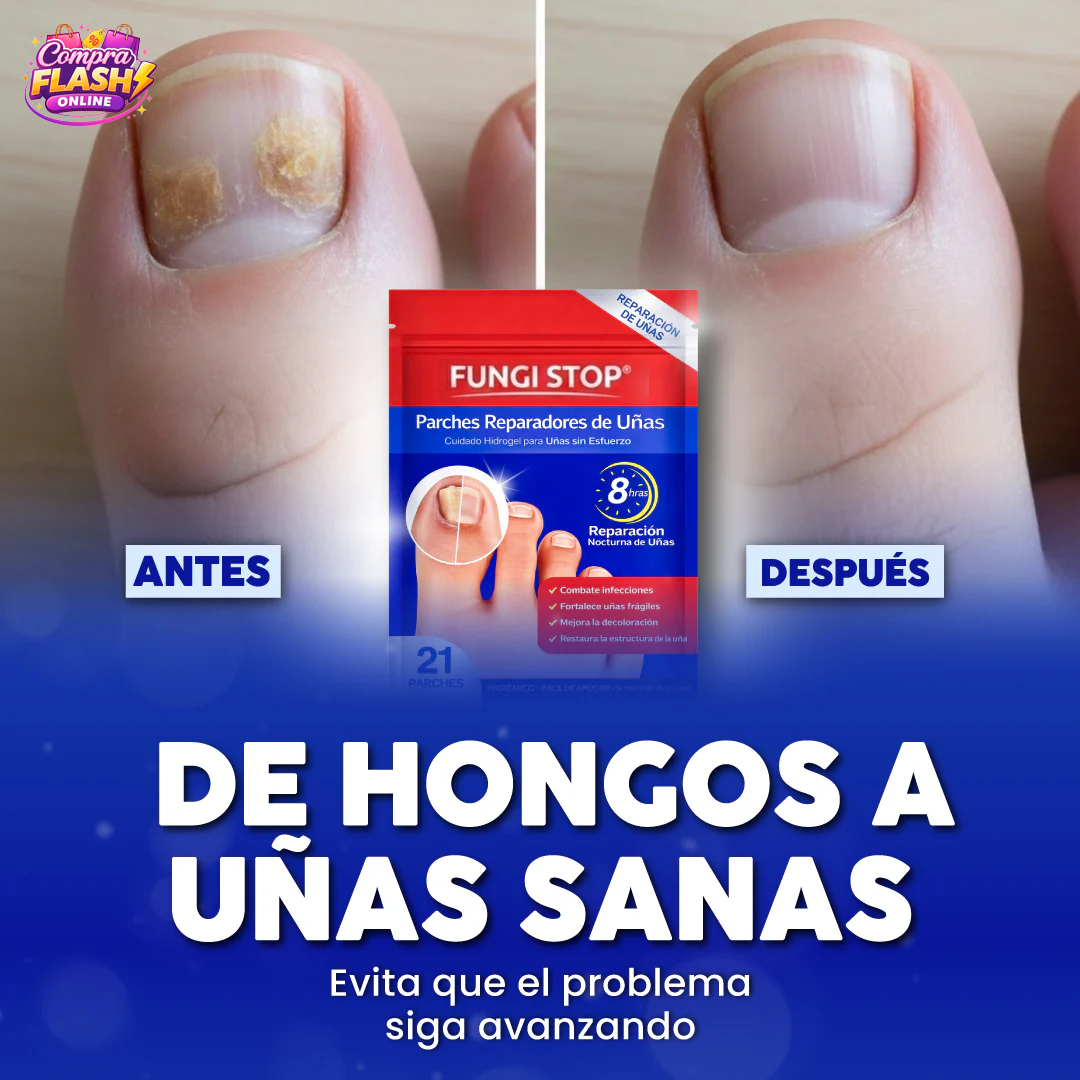 🔥 PACK 2x1 – SEGUNDA UNIDAD Y ENVÍO GRATIS 🦶PARCHES ANTIHONGOS PARA UÑAS DE PIES FUNGISTOP™ ⭐️⭐️⭐️⭐️⭐️