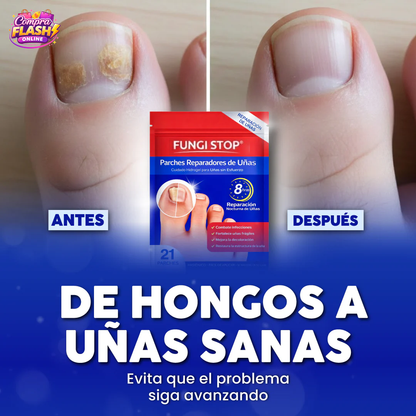 🔥 PACK 2x1 – SEGUNDA UNIDAD Y ENVÍO GRATIS 🦶PARCHES ANTIHONGOS PARA UÑAS DE PIES FUNGISTOP™ ⭐️⭐️⭐️⭐️⭐️