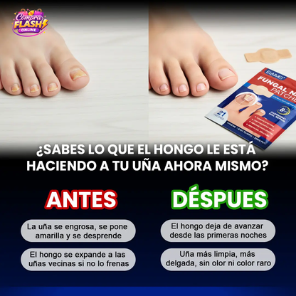 🔥 PACK 2x1 – SEGUNDA UNIDAD Y ENVÍO GRATIS 🦶PARCHES ANTIHONGOS PARA UÑAS DE PIES FUNGISTOP™ ⭐️⭐️⭐️⭐️⭐️